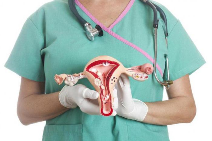 симптомы рака яичников у женщин признаки 