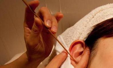 точечки массажа на ушах