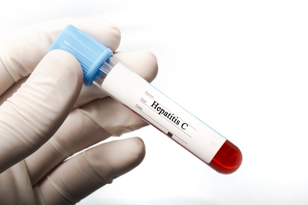 Анализ крови на гепатит