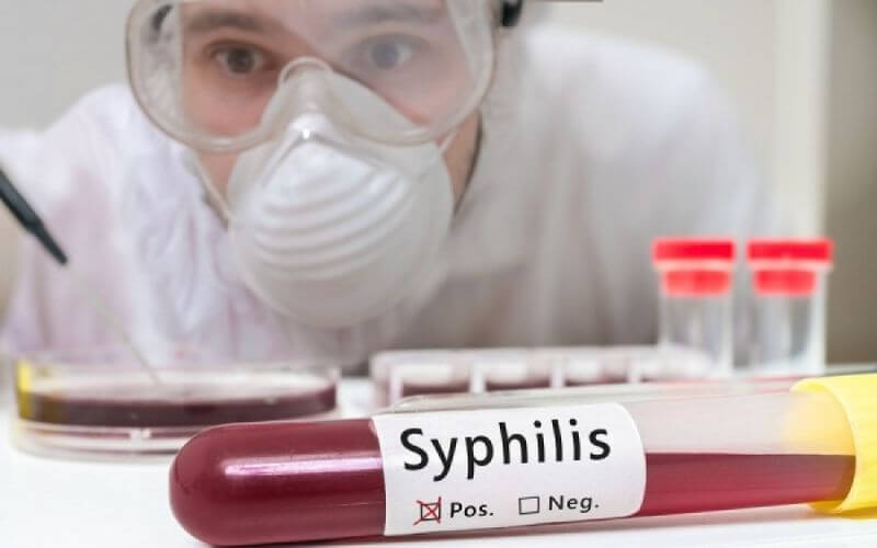 Кровь на сифилис
