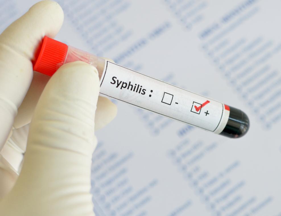 Первичный период сифилиса