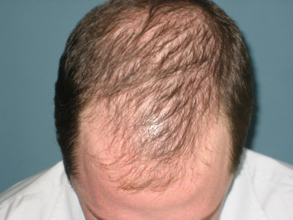 Витамины для волос для мужчин: обзор эффективных препаратов, действие, отзывы