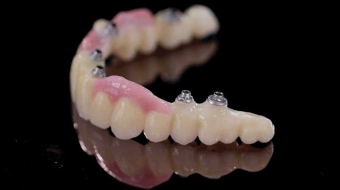 технологии в стоматологии коронки