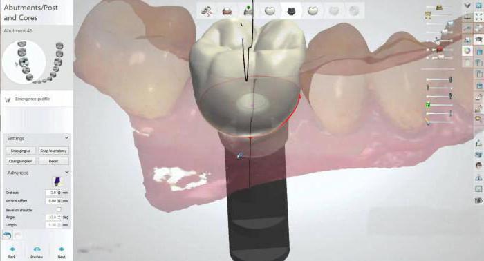 новейшие технологии в стоматологии