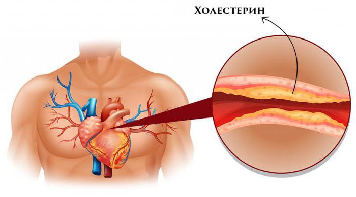 холестерин обозначение в анализе крови