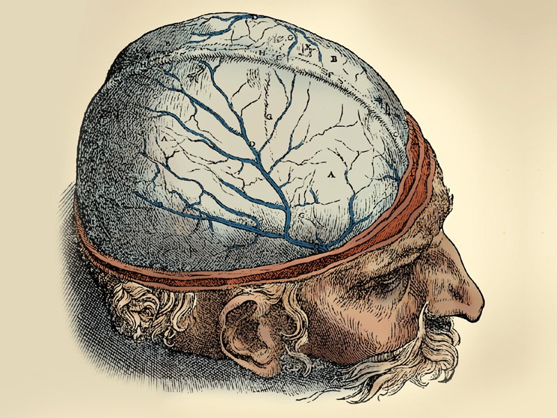 гидроцефалия головного мозга симптомы