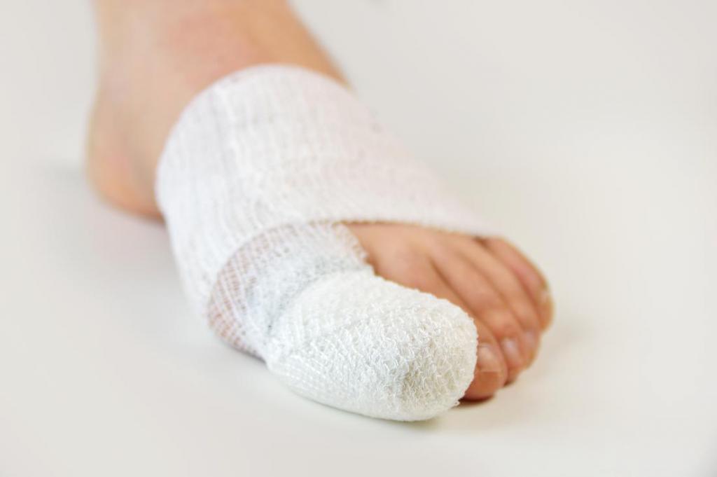 перелом пальца на ноге симптомы перелом пальца на ноге симптомы