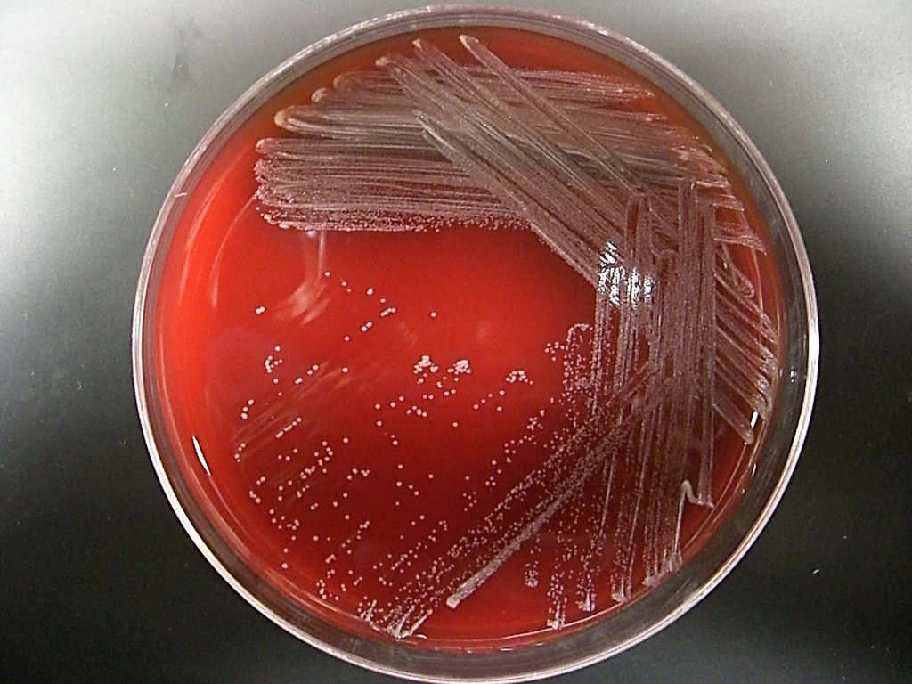 corynebacterium diphtheriae 