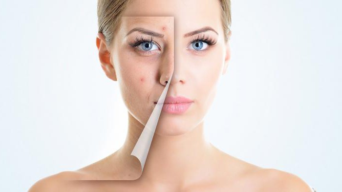 Гель "Регецин" от морщин: отзывы косметологов, особенности применения и эффективность