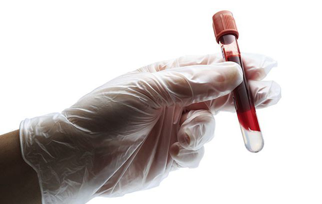 анализ крови гемостаз