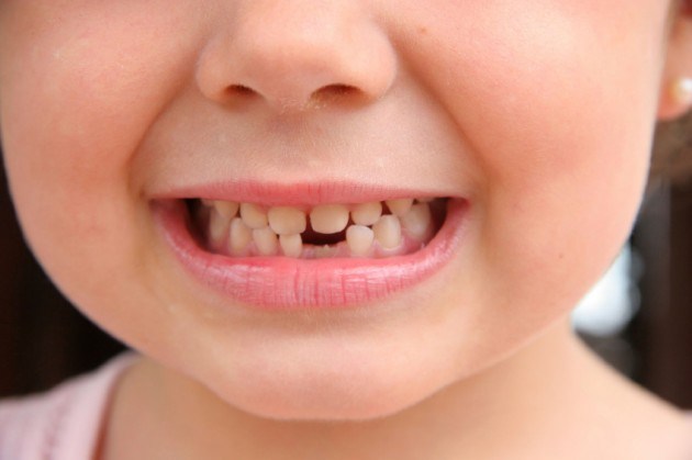 коренастые зубы у детишек