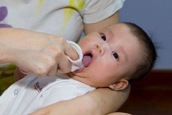Как исцелять молочницу во рту