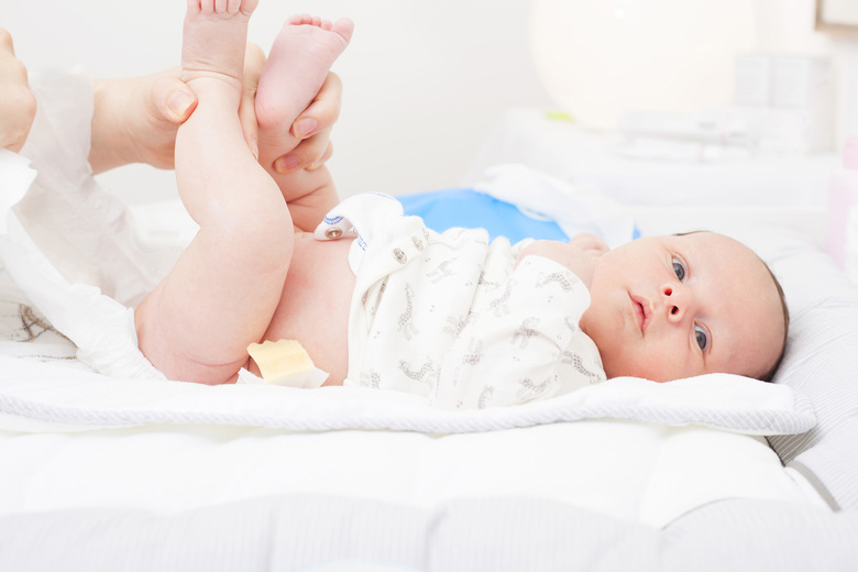 Прыщики у новорожденных на теле: причины, диагностика и методы лечения. Пеленочный дерматит у новорожденных