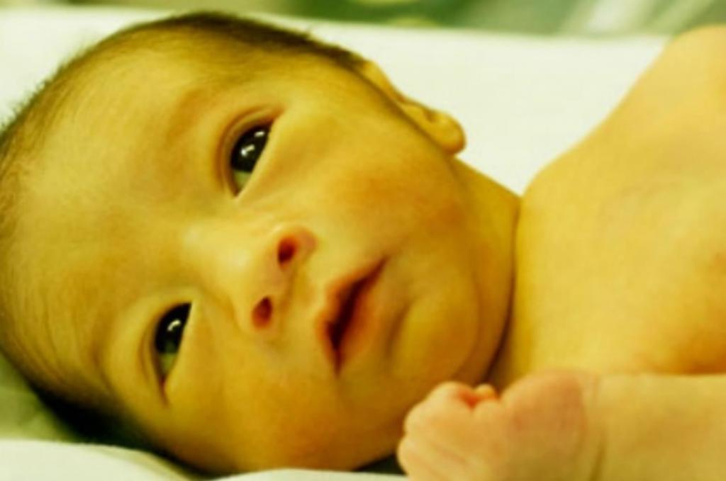 физиологическая желтуха новорожденных норма билирубина