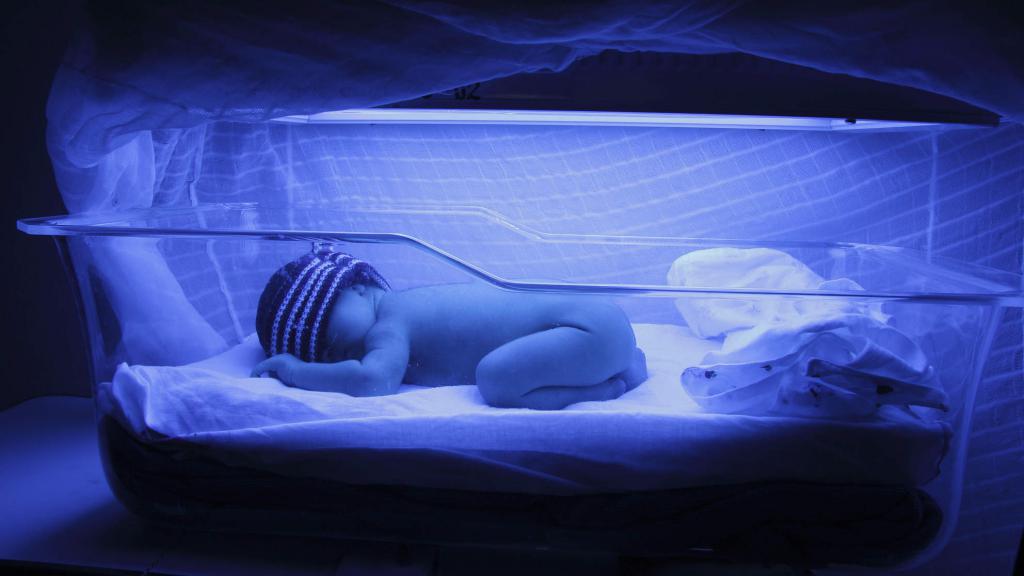 физиологическая желтуха новорожденного развивается в результате