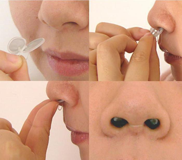 фильтры для носа от аллергии