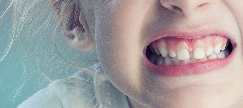 Зубы ребенка