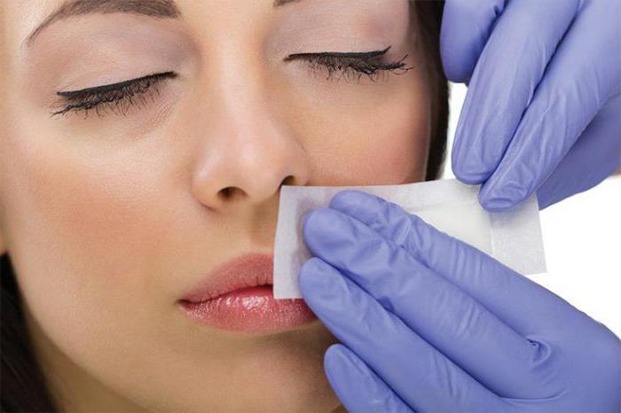 Эпиляция верхней губы: отзывы о лазерной и восковой процедуре