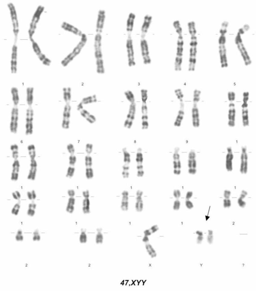 Процесс деления хромосом