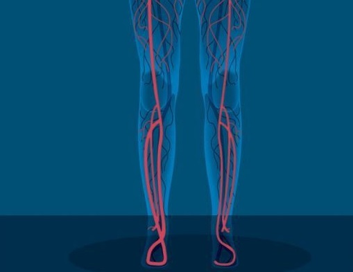 заболевание ног вены