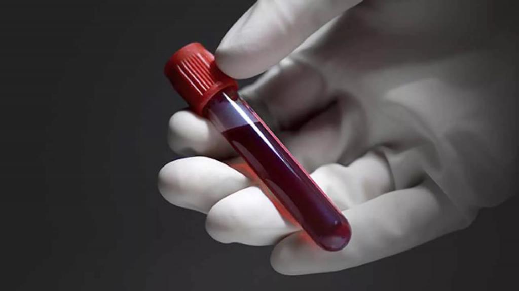 Анализ крови на ревмопробы