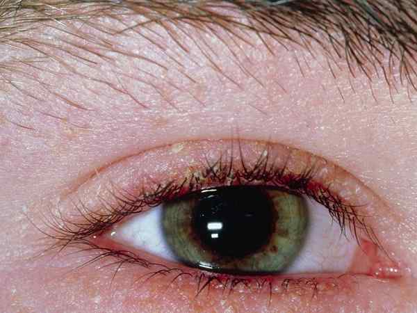 левомицетин для глаз аннотация по использованию