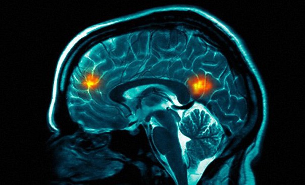 Опухоль ствола головного мозга у детей прогноз