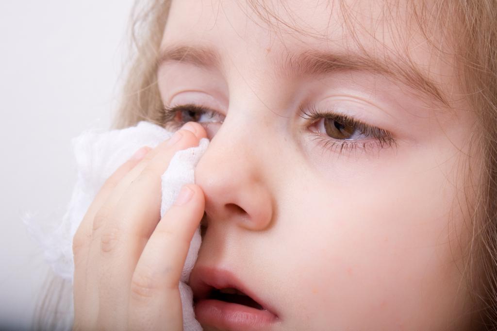 аллергическая реакция у ребенка