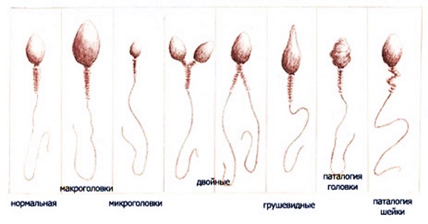морфология сперматозоида 