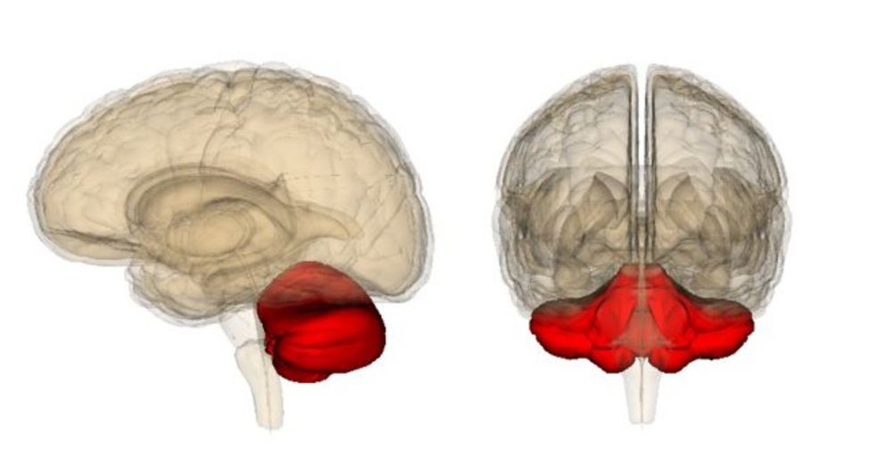 инсульт мозжечка инсульт мозжечка головного мозга