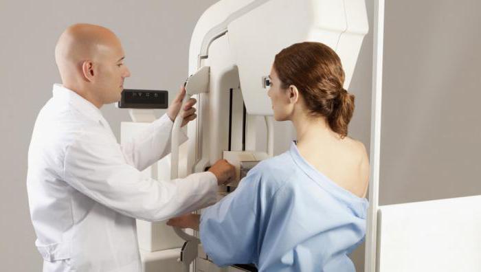 что информативнее узи молочных желез или маммография