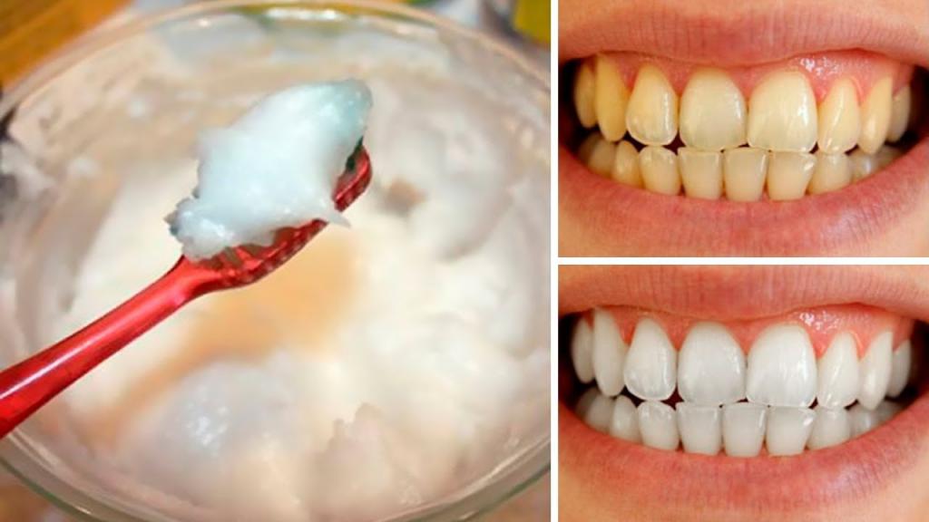 Зубы после перекиси водорода