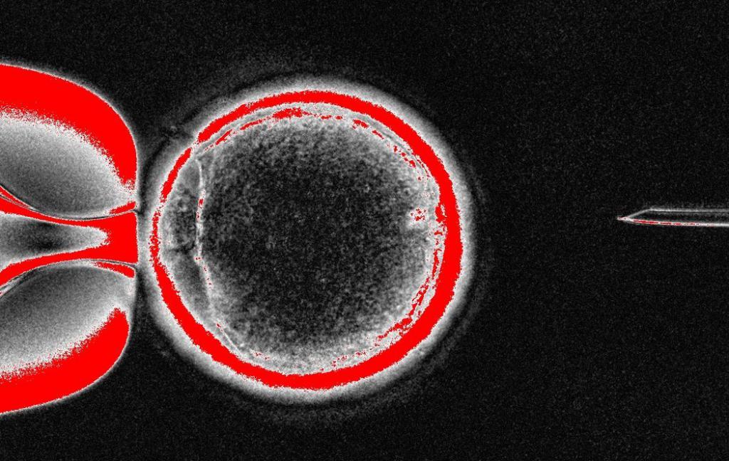 эмбриональные стволовые клетки человека