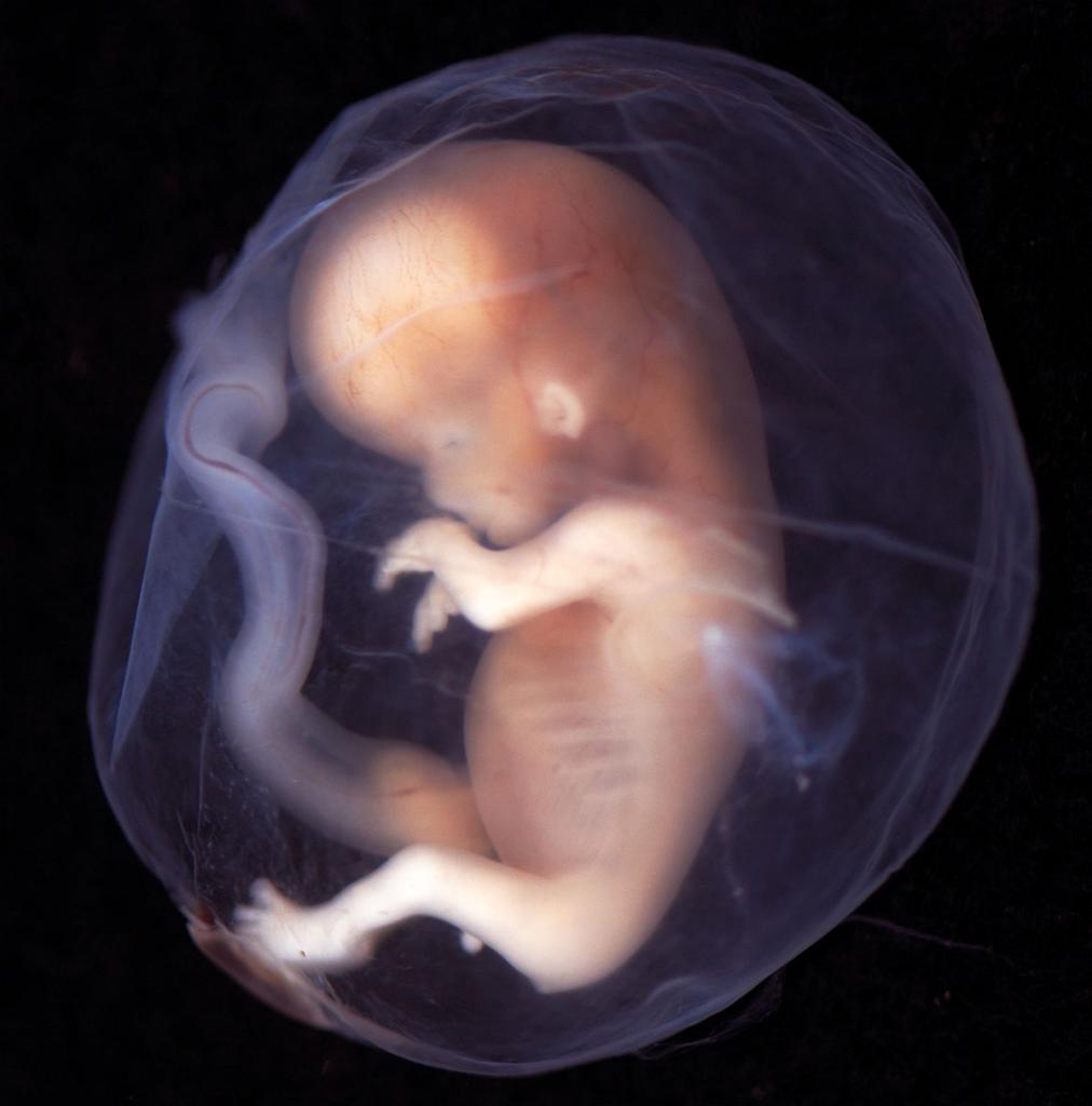 эмбрион на ранних сроках