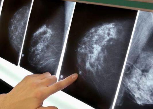 чем маммография отличается от узи молочных желез