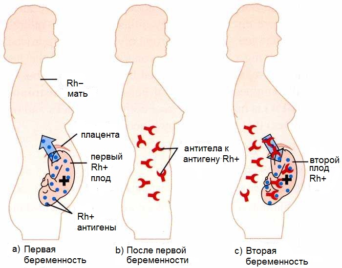 Развитие резус-конфликта