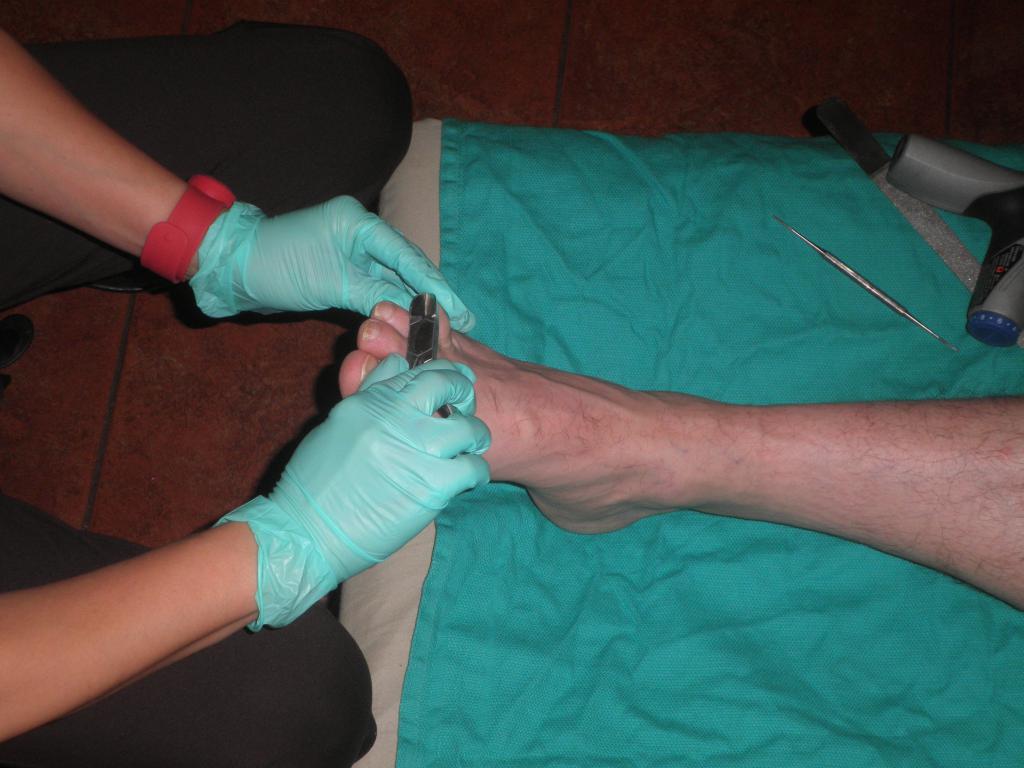 Трескается кожа на ногах: возможные причины и методы лечения