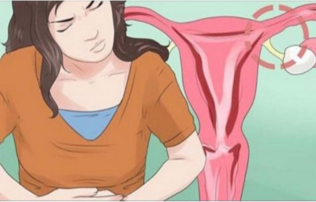 боль во время менструации