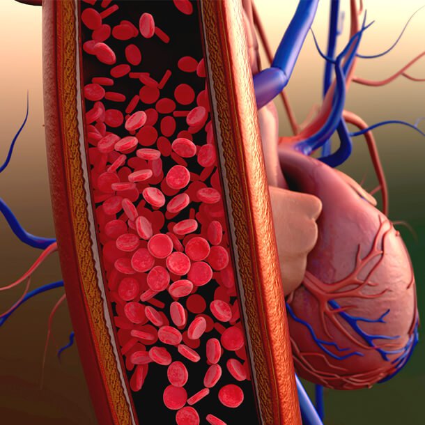 Переизбыток крови в сосудах при гипертонии