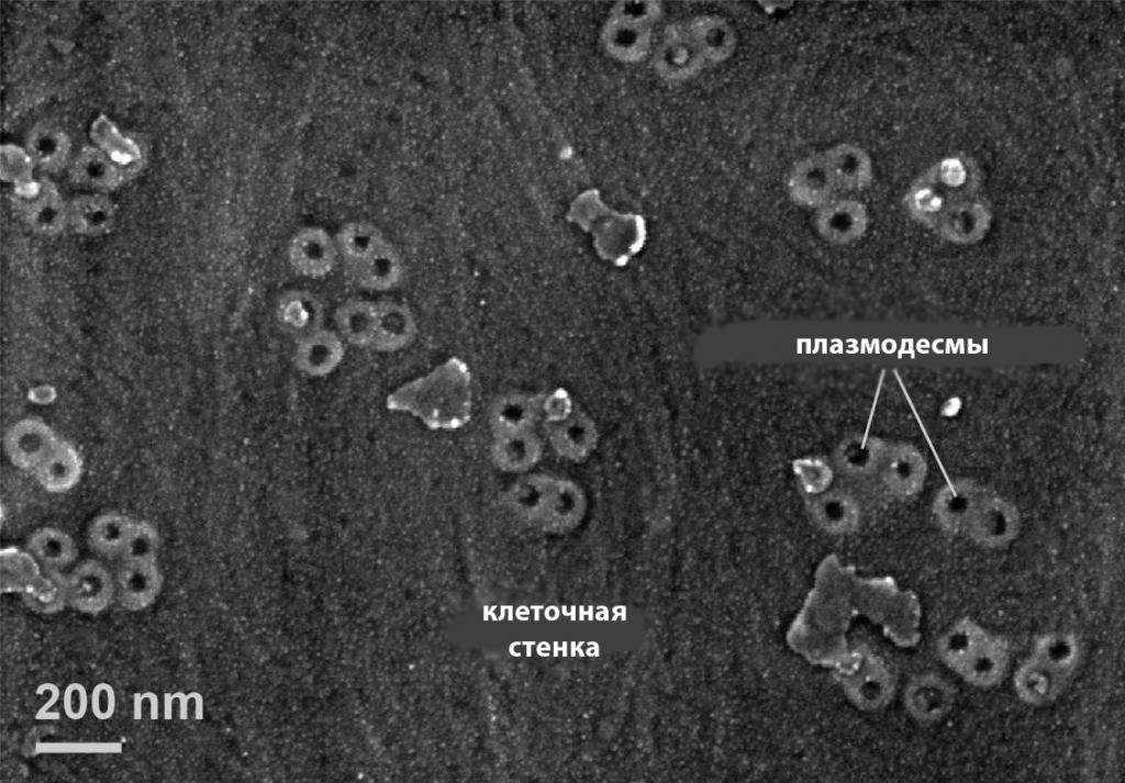 плазмодесмы и клеточная стенка (микрофотография)