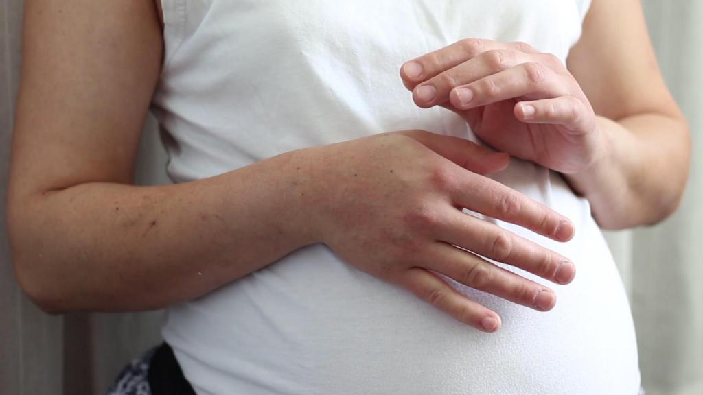 отечность кистей рук при беременности
