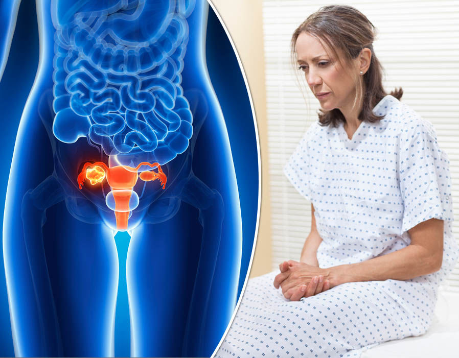 симптомы рака женских половых органов