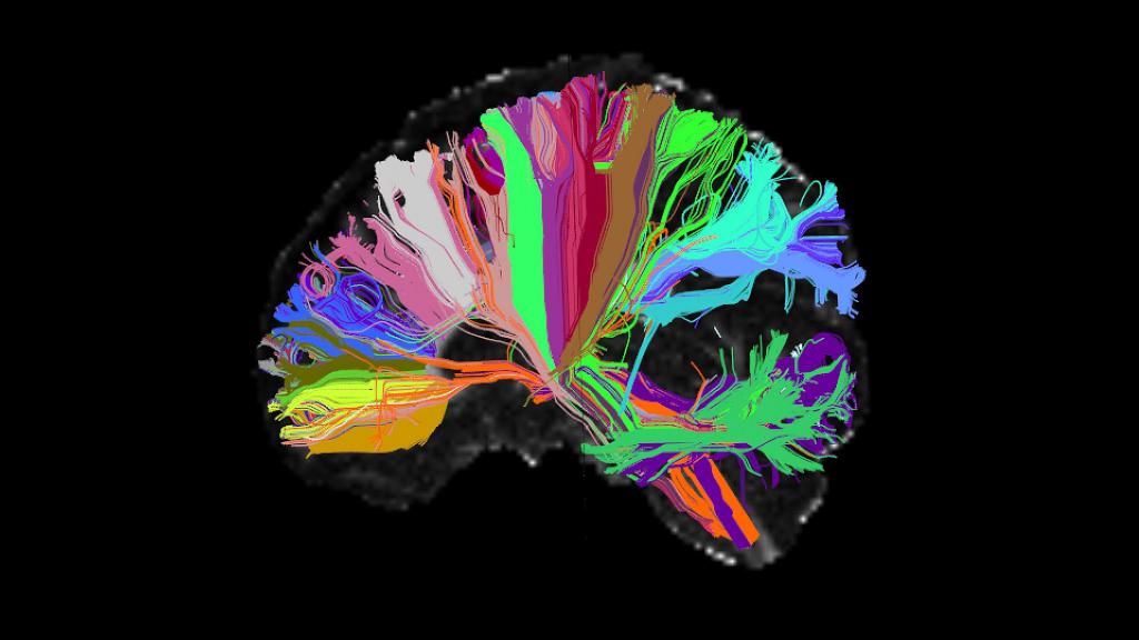 Мозг человека в цвете