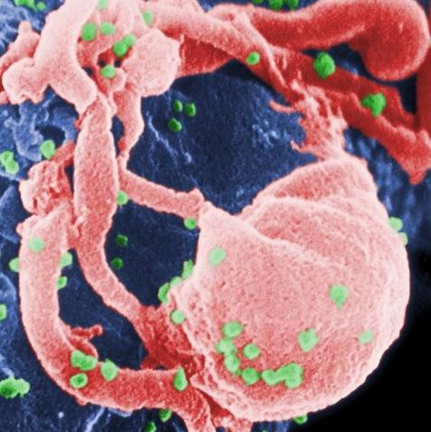 Что такое СПИД и ВИЧ