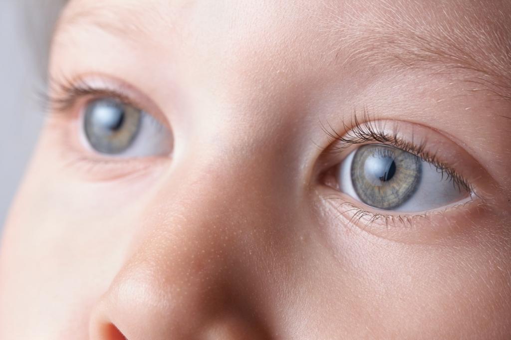 врожденная катаракта у детей