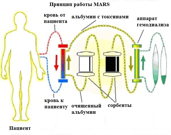 Принцип работы МАРС