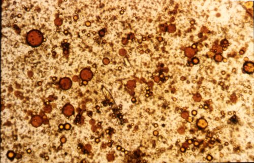 Клетки кала под микроскопом