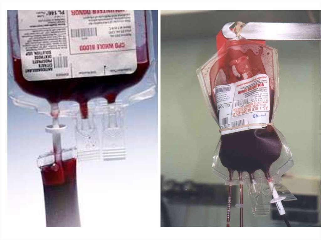 переливание компонентов крови