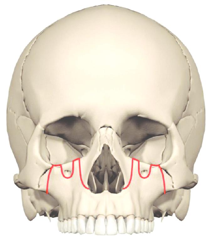 верхняя челюсть на черепе