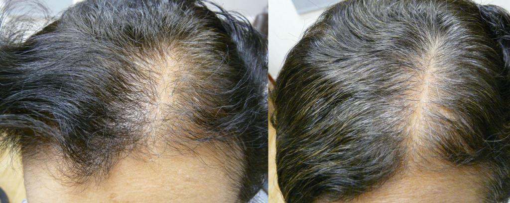 Витаминизированный тоник для волос "Кармазин": состав, применение, отзывы